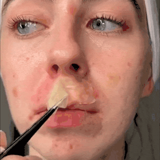 SkinBond Repair - Alisa la imperfección mientras duermes