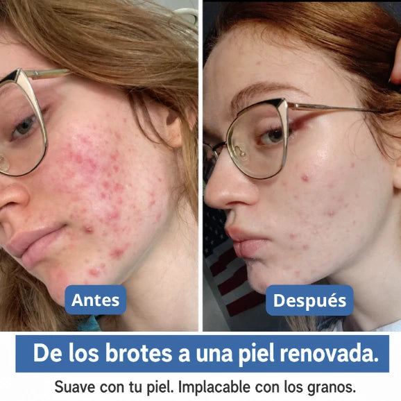 SkinBond Repair - Alisa la imperfección mientras duermes