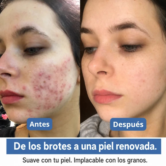 SkinBond Repair - Alisa la imperfección mientras duermes