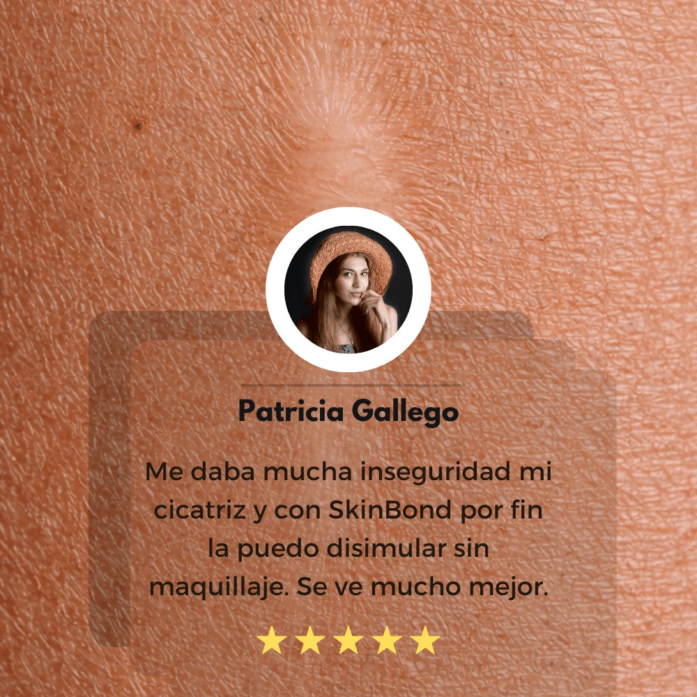 SkinBond - Cicatrices menos visibles en semanas